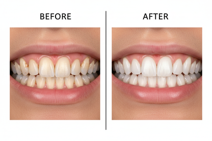 one picture of before and after before yellow teeth after white shining teeth